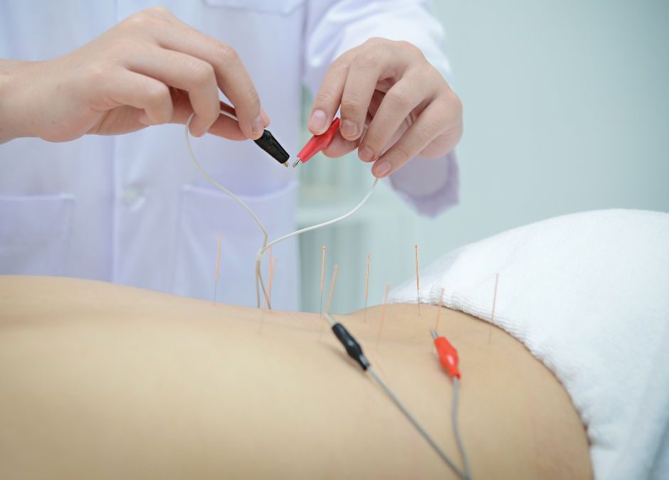 How Acupuncture Can Help You with Your Back Pain?