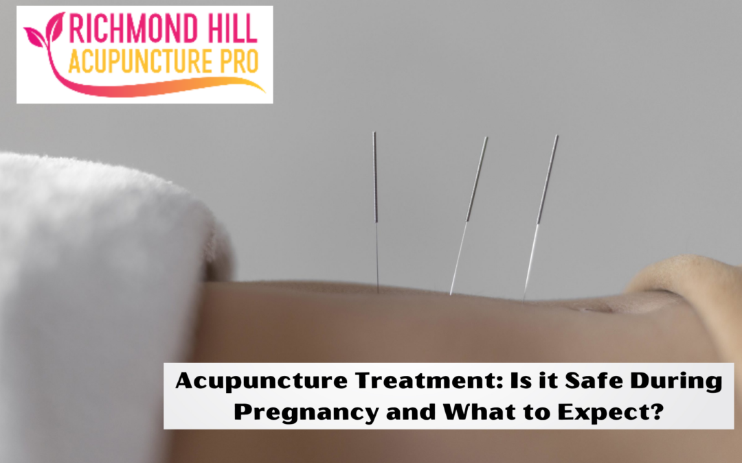 Acupuncture Treatment: Is It Safe During Pregnancy And What To Expect? – Richmond Hill Acupuncture Pro