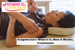 Acupuncture What is it, How it Works, Treatments